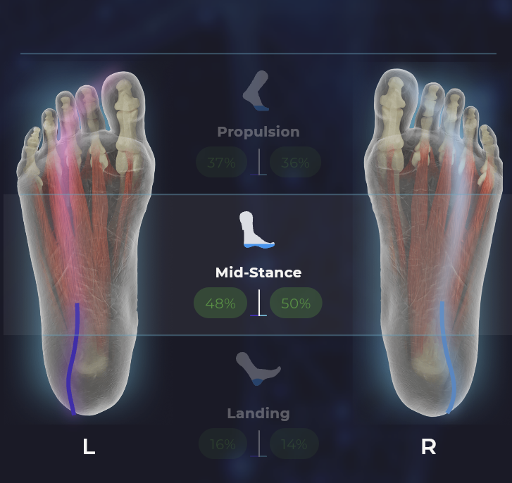 Gait / Running Analysis